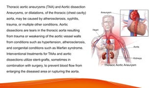 Thoracic aortic aneurysms (TAA) and Aortic dissection
Aneurysms, or dilatations, of the thoracic (chest cavity)
aorta, may be caused by atherosclerosis, syphilis,
trauma, or multiple other conditions. Aortic
dissections are tears in the thoracic aorta resulting
from trauma or weakening of the aortic vessel walls
from conditions such as hypertension, atherosclerosis,
and congenital conditions such as Marfan syndrome.
Interventional treatments for TAAs and aortic
dissections utilize stent-grafts, sometimes in
combination with surgery, to prevent blood flow from
enlarging the diseased area or rupturing the aorta.
 