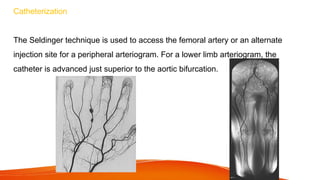 Catheterization
The Seldinger technique is used to access the femoral artery or an alternate
injection site for a peripheral arteriogram. For a lower limb arteriogram, the
catheter is advanced just superior to the aortic bifurcation.
 