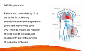 IVC filter placement
Patients who have a history of, or
are at risk for, pulmonary
embolism may receive temporary or
permanent inferior vena cava
(IVC) filters to prevent the migration
of blood clots to the lungs, and
consequently prevent recurrence
of pulmonary embolism.
 