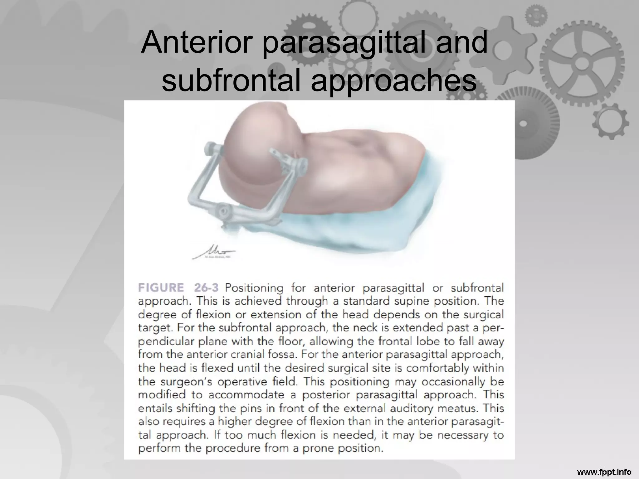 Anterior parasagittal and
subfrontal approaches
 