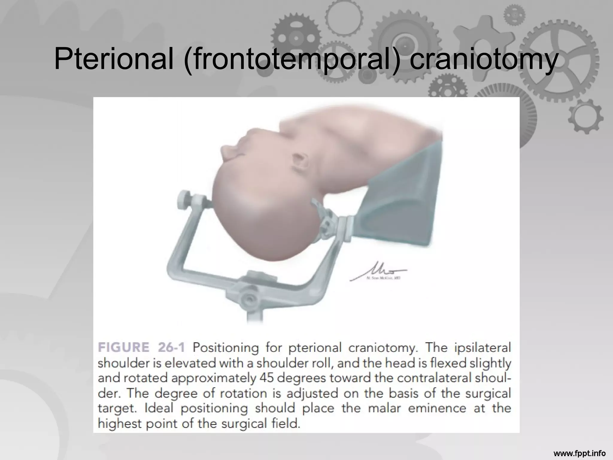 Pterional (frontotemporal) craniotomy
 