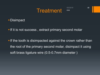 027 Ectopic Eruption of Max Canine.pdfiii | PDF