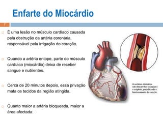  É uma lesão no músculo cardíaco causada
pela obstrução da artéria coronária,
responsável pela irrigação do coração.
 Quando a artéria entope, parte do músculo
cardíaco (miocárdio) deixa de receber
sangue e nutrientes.
 Cerca de 20 minutos depois, essa privação
mata os tecidos da região atingida.
 Quanto maior a artéria bloqueada, maior a
área afectada.
7
 