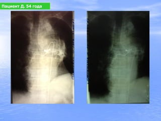 Пациент Д. 54 года
 