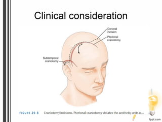 Clinical consideration
 