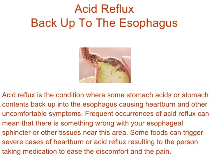 What Are Acid Reflux Allergies?