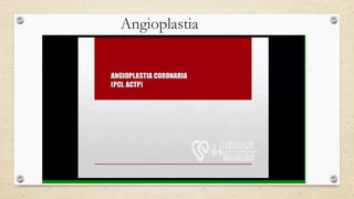 Angioplastia
 
