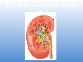 Riñon derecho seccionado en diversos
planos
 