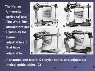 The Hanau
University
series (a) and
The Whip-Mix
articulators are
Examples for
Semi-
adjustable art.
that have
adjustable,
horizontal and lateral Condylar paths, and adjustable
incisal guide tables (C)
 