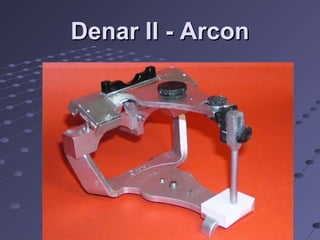 Denar II - ArconDenar II - Arcon
 