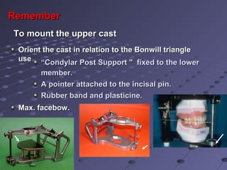 RememberRemember
To mount the upper castTo mount the upper cast
““Condylar Post Support " fixed to the lowerCondylar Post Support " fixed to the lower
member.member.
A pointer attached to the incisal pin.A pointer attached to the incisal pin.
Rubber band and plasticine.Rubber band and plasticine.
Orient the cast in relation to the Bonwill triangleOrient the cast in relation to the Bonwill triangle
useuse
Max. facebow.Max. facebow.
 