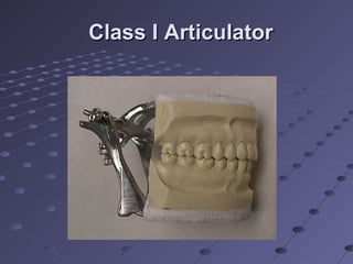 Class I ArticulatorClass I Articulator
 