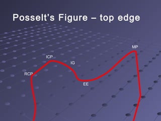 Posselt’s Figure – top edge
RCP
ICP
IG
EE
MP
 