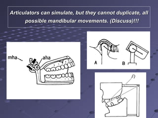 Articulators can simulate, but they cannot duplicate, allArticulators can simulate, but they cannot duplicate, all
possible mandibular movements. (Discuss)!!!possible mandibular movements. (Discuss)!!!
 