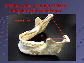4”
4”
BONWILL 1854
2-Mean value, average or fixed2-Mean value, average or fixed
condylar path articulatorscondylar path articulators
 