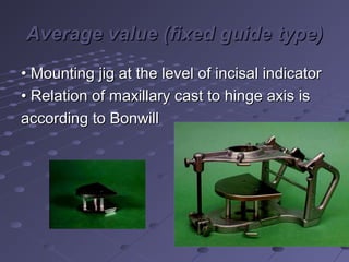 Average value (fixed guide type)Average value (fixed guide type)
•• Mounting jig at the level of incisal indicatorMounting jig at the level of incisal indicator
•• Relation of maxillary cast to hinge axis isRelation of maxillary cast to hinge axis is
according to Bonwillaccording to Bonwill
 