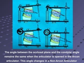 The angle between the occlusal plane and the condylar angle
remains the same when the articulator is opened in the Arcon
articulator. This angle changes in a Non-Arcon Articulator
 