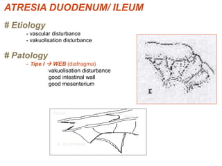 ATRESIA DUODENUM/ ILEUM
# Etiology
- vascular disturbance
- vakuolisation disturbance
# Patology
- Tipe I  WEB (diafragma)
vakuolisation disturbance
good intestinal wall
good mesenterium
Parsial
Total
A. Drummond
 