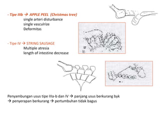 - Tipe IIIb  APPLE PEEL (Christmas tree)
single arteri disturbance
single vasculrize
Deformitas
- Tipe IV  STRING SAUSAGE
Multiple atresia
length of intestine decrease
Penyambungan usus tipe IIIa-b dan IV  panjang usus berkurang byk
 penyerapan berkurang  pertumbuhan tidak bagus
 