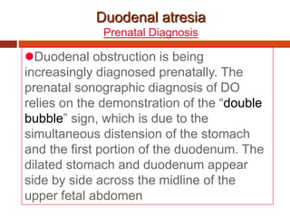 Duodenal atresia
Prenatal Diagnosis
Duodenal obstruction is being
increasingly diagnosed prenatally. The
prenatal sonographic diagnosis of DO
relies on the demonstration of the “double
bubble” sign, which is due to the
simultaneous distension of the stomach
and the first portion of the duodenum. The
dilated stomach and duodenum appear
side by side across the midline of the
upper fetal abdomen
 