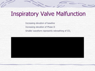 02 capnography | PPT