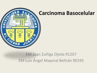 Carcinoma Basocelular




   EM Juan Zuñiga Ojeda 91207
EM Luis Ángel Mayoral Beltrán 90195
 