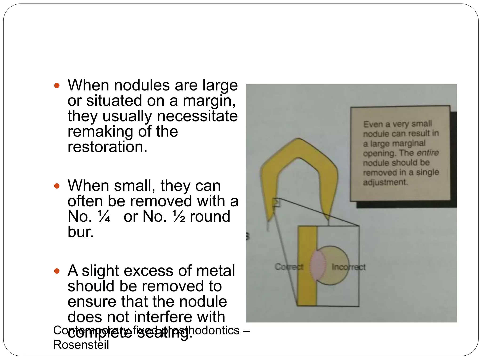  When nodules are large
or situated on a margin,
they usually necessitate
remaking of the
restoration.
 When small, they can
often be removed with a
No. ¼ or No. ½ round
bur.
 A slight excess of metal
should be removed to
ensure that the nodule
does not interfere with
complete seating.
Contemporary fixed prosthodontics –
Rosensteil
 