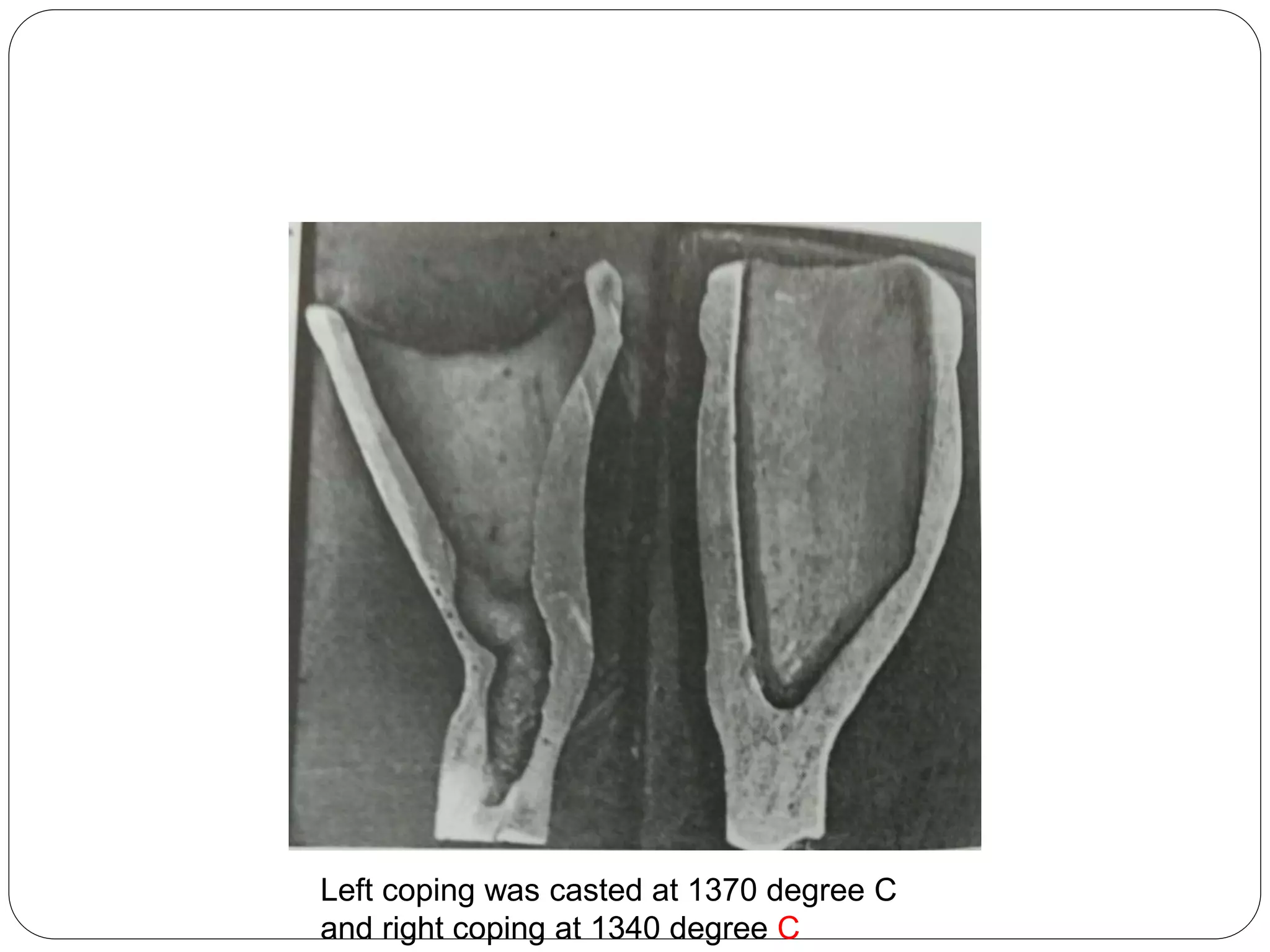 Left coping was casted at 1370 degree C
and right coping at 1340 degree C
 