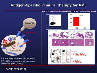 Shared Resources
Flow Cytometry and Cellular Imaging Facility, Genetically Engineered Mouse
Facility, Monoclonal Antibody Facility; Clinical Trials Support Resource
Antigen-Specific Immune Therapy for AML
P3
NE
Leukemia
PR1 peptide
PR1
PR1-CTL
Clinical trials with cord blood-derived
PR1-CTL are ongoing for transplant
recipients (AML, CML)
PR1-CTL are naturally enriched (0.1-0.4%) in fetal cord blood
AML
No AML
Molldrem et al
 