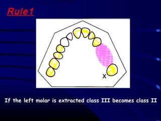 02 classification and indications of rpd | PPT