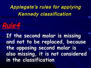 Appleton Rule 02 classification and indications of rpd | PPT