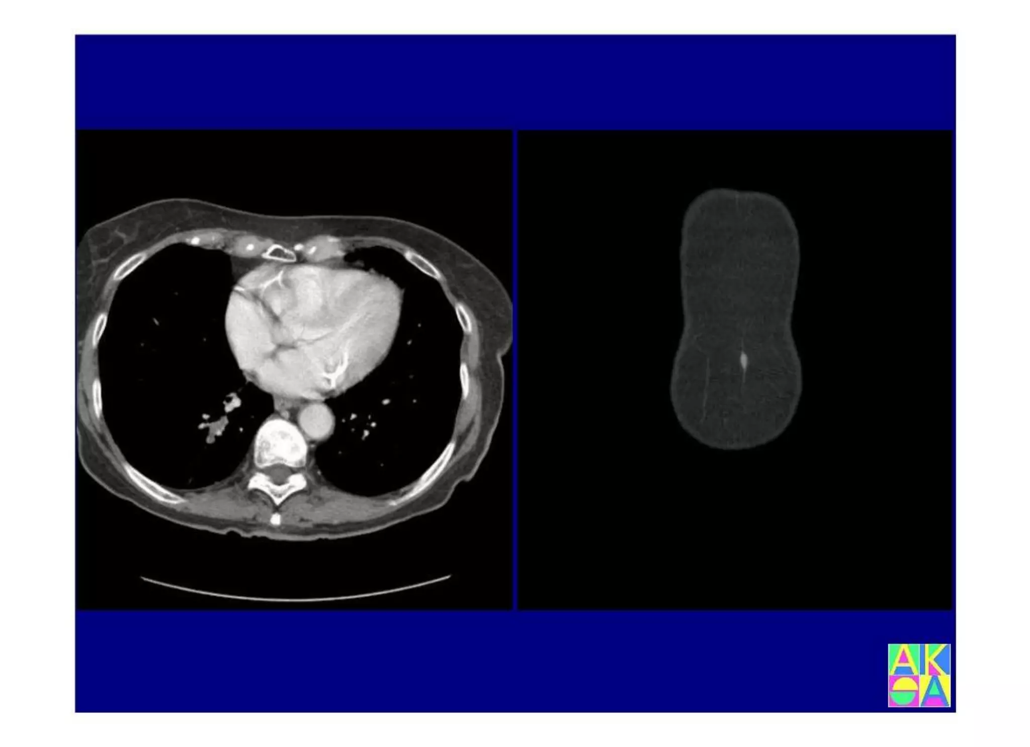 15.502 Darmerkrankungen, Ileus und akutes Abdomen.