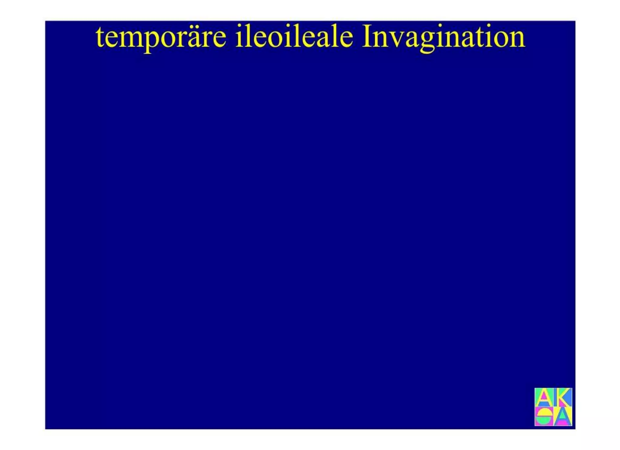 15.502 Darmerkrankungen, Ileus und akutes Abdomen.