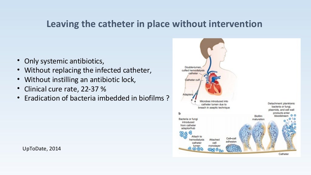 hemodialysis catheter infection
