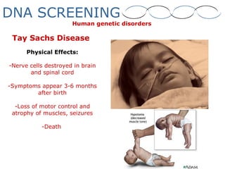 Tay Sachs Disease
Physical Effects:
-Nerve cells destroyed in brain
and spinal cord
-Symptoms appear 3-6 months
after birth
-Loss of motor control and
atrophy of muscles, seizures
-Death
Human genetic disorders
DNA SCREENING
 