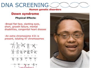Down syndrome
Physical Effects:
-Broad flat face, slanting eyes,
short, growth failure, mental
disabilities, congenital heart disease
-An extra chromosome #21 is
present, totaling 47 chromosomes
Human genetic disorders
DNA SCREENING
 