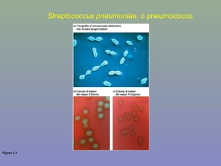 Figura 2.1
Streptococcus pneumoniae, o pneumococco
 