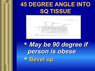 45 DEGREE ANGLE INTO45 DEGREE ANGLE INTO
SQ TISSUESQ TISSUE
 May be 90 degree ifMay be 90 degree if
person is obeseperson is obese
 Bevel upBevel up
 