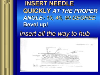 INSERT NEEDLEINSERT NEEDLE
QUICKLYQUICKLY AT THE PROPERAT THE PROPER
ANGLE-ANGLE- 15, 45, 90 DEGREE15, 45, 90 DEGREE
Bevel up!Bevel up!
Insert all the way to hubInsert all the way to hub
 