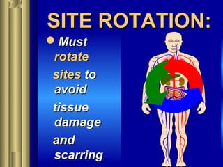 SITE ROTATION:SITE ROTATION:
MustMust
rotaterotate
sitessites toto
avoidavoid
tissuetissue
damagedamage
andand
scarringscarring
 