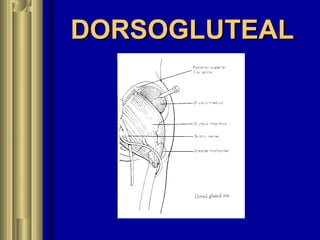DORSOGLUTEALDORSOGLUTEAL
 