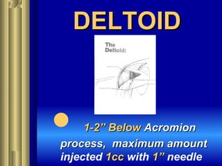DELTOIDDELTOID
 1-2” Below1-2” Below AcromionAcromion
process, maximum amountprocess, maximum amount
injected 1cc1cc with 1”1” needle
 
