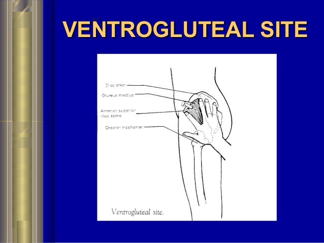 ventrogluteal injection site ventrogluteal injection site