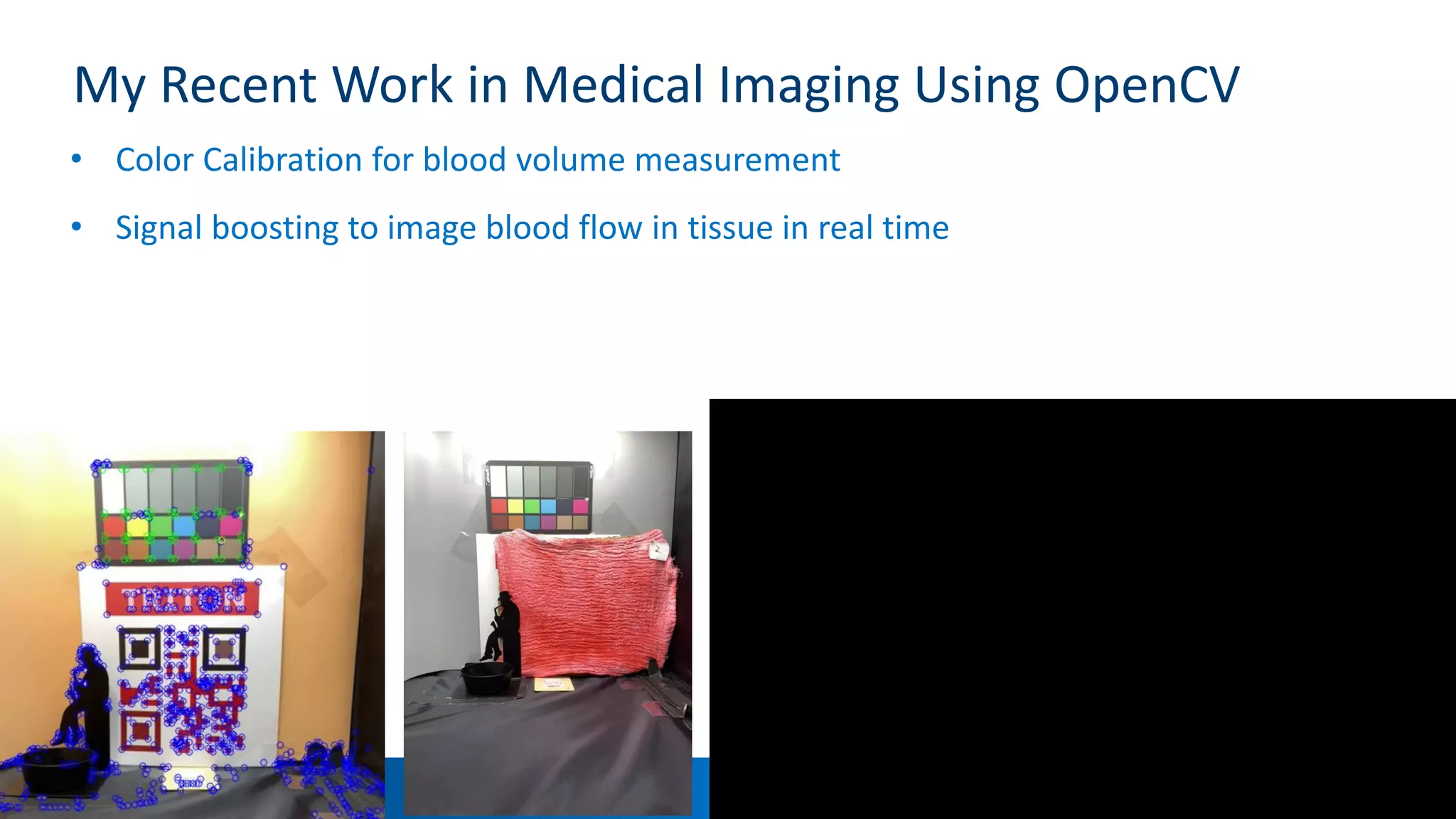 19
My Recent Work in Medical Imaging Using OpenCV
• Color Calibration for blood volume measurement
• Signal boosting to image blood flow in tissue in real time
 