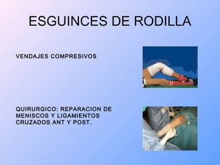 ESGUINCES DE RODILLA
VENDAJES COMPRESIVOS
QUIRURGICO: REPARACION DE
MENISCOS Y LIGAMIENTOS
CRUZADOS ANT Y POST.
 