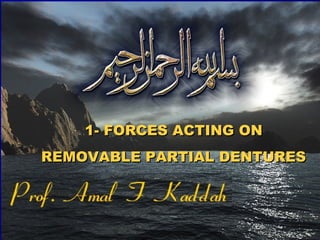 1- FORCES ACTING ON1- FORCES ACTING ON
REMOVABLE PARTIAL DENTURESREMOVABLE PARTIAL DENTURES
 