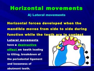 Horizontal Movement Key 1. forces acting on rpd | PPT