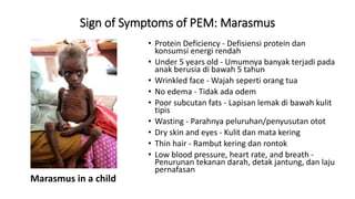 02 Gangguan Akibat KEP Protein Energy Malnutrition 2023.pptx