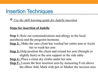 Jadele Tab 02=Jadelle (1).pptx for long acting method | PPTX