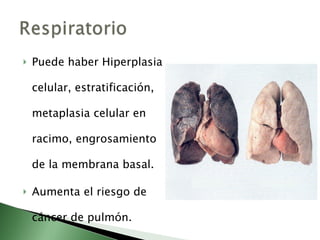 Puede haber Hiperplasia celular, estratificación, metaplasia celular en racimo, engrosamiento de la membrana basal.  Aumenta el riesgo de cáncer de pulmón. 